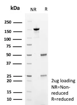 TARDBP Antibody