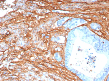 POSTN Antibody