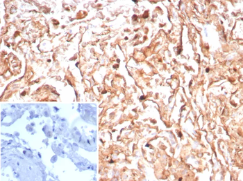 PDPN Antibody