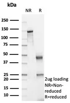 PDPN Antibody