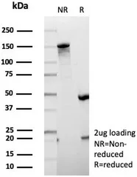 EBI3 Antibody