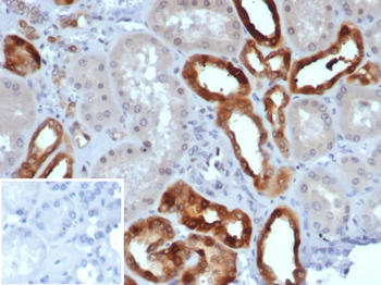 PVALB Antibody