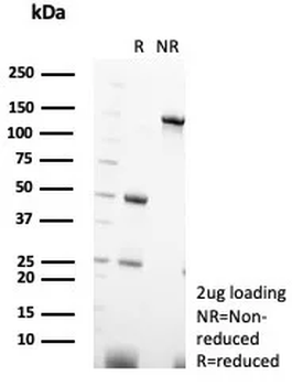 PVALB Antibody