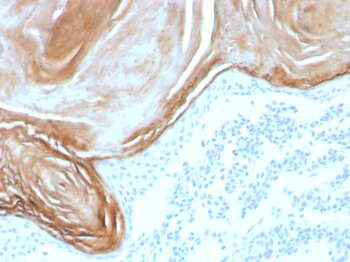 KLK7 Antibody