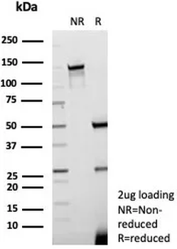 KLK7 Antibody