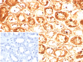 SERPINA1 Antibody