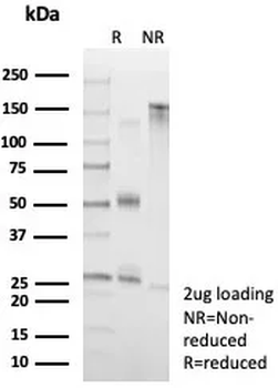 SERPINA1 Antibody