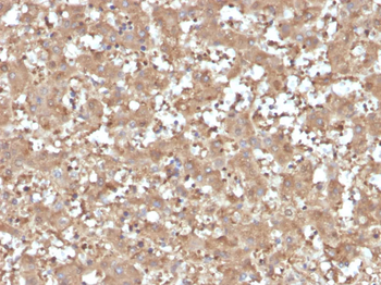SERPINA1 Antibody