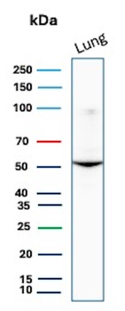 SERPINA1 Antibody