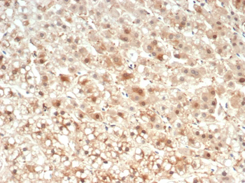 IL-6 (Interleukin-6) / Interferon beta-2 (Hybridoma Growth Factor) Antibody