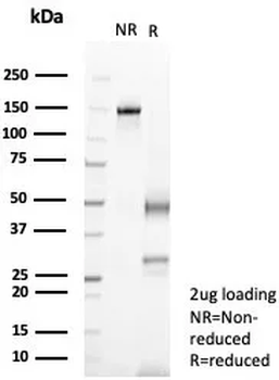 IL-6 (Interleukin-6) / Interferon beta-2 (Hybridoma Growth Factor) Antibody
