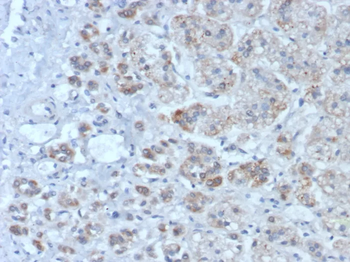 IL1RN Antibody