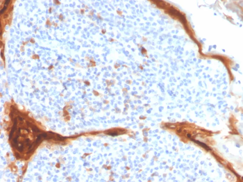 IL1RN Antibody