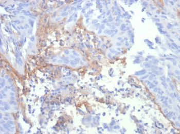 Tenascin C (Stromal Marker for Epithelial Malignancy) Antibody