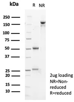 Tenascin C (Stromal Marker for Epithelial Malignancy) Antibody