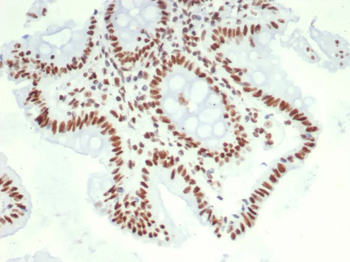 HDGF Antibody