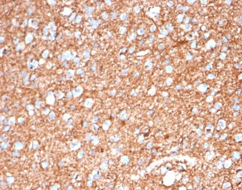 GFAP (Astrocyte & Neural Stem Cell Marker) Antibody