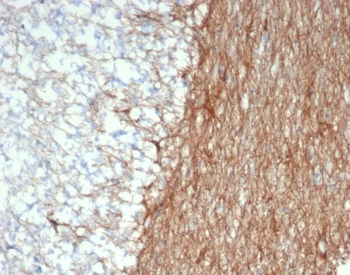 GFAP (Astrocyte & Neural Stem Cell Marker) Antibody