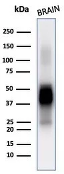 GFAP (Astrocyte & Neural Stem Cell Marker) Antibody