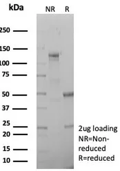 Recombinant Collagen II (COL2A1) Antibody