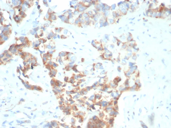 TNFRSF17 Antibody