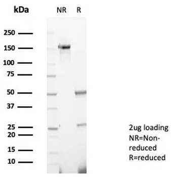TNFRSF17 Antibody