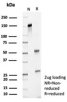 Recombinant Survivin / BIRC5 Antibody