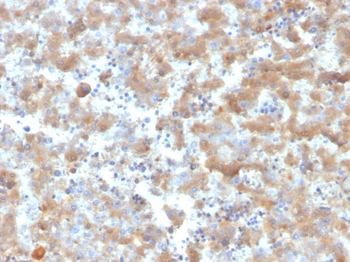 A2M Antibody