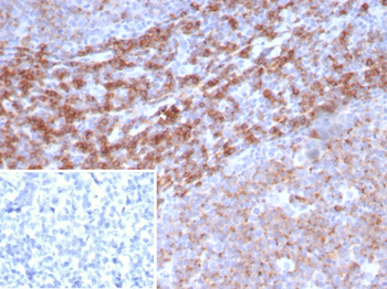 ENTPD1 Antibody