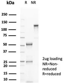 MS4A1 Antibody