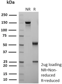 Recombinant CD36 (Platelet & Microvessel Marker) Antibody