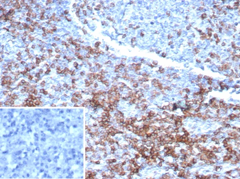 Recombinant CD3e (T-Cell Marker) Antibody