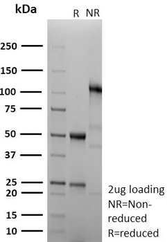 Recombinant Cyclin B1 (G2- & M-phase Cyclin) Antibody