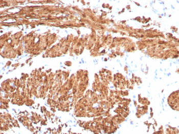 CNN1 Antibody