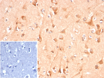 ADCY8 Antibody