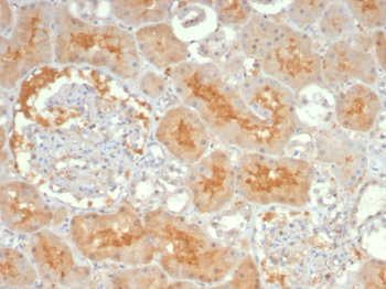 ADCY8 Antibody