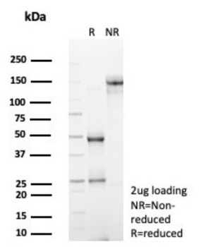 ADCY8 Antibody