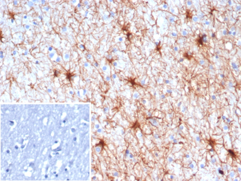 NTRK3 Antibody