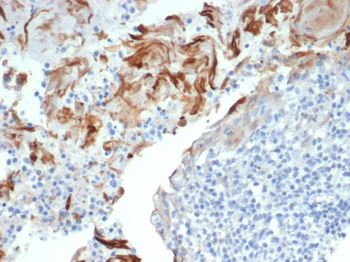 NTRK3 Antibody