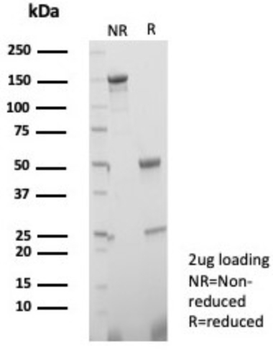 TGFB3 Antibody