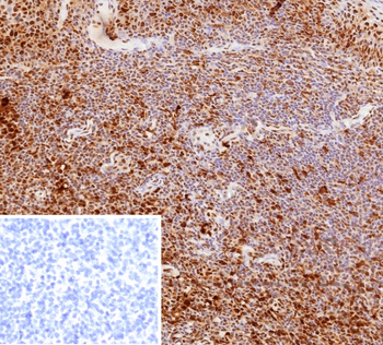 PCNA Antibody