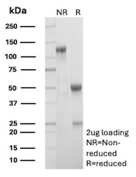 CALCA Antibody