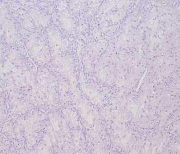 TFE3 Antibody