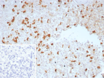 TGFB1 Antibody