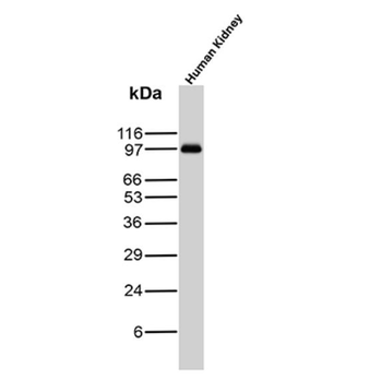 Recombinant Complement 4d (C4d) (Acute Humoral Rejection Marker) Antibody