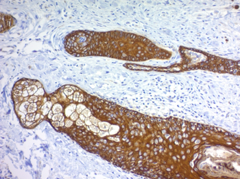 KRT77 Antibody