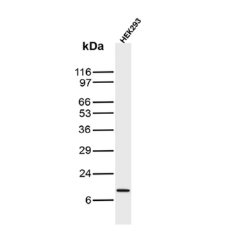 NA, SAA1 Antibody