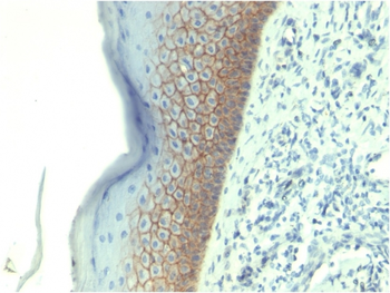 CDH1 Antibody