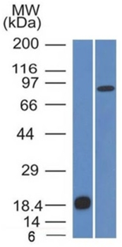 CDH1 Antibody