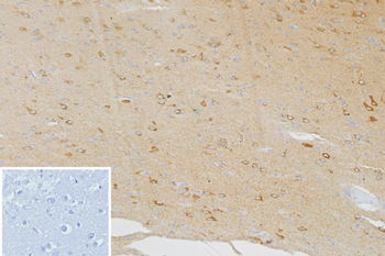 CXCR5 Antibody